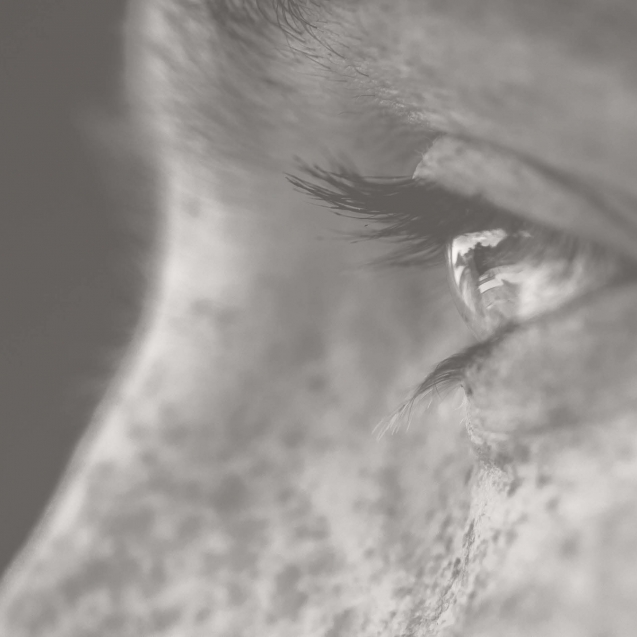 pigmentation story header