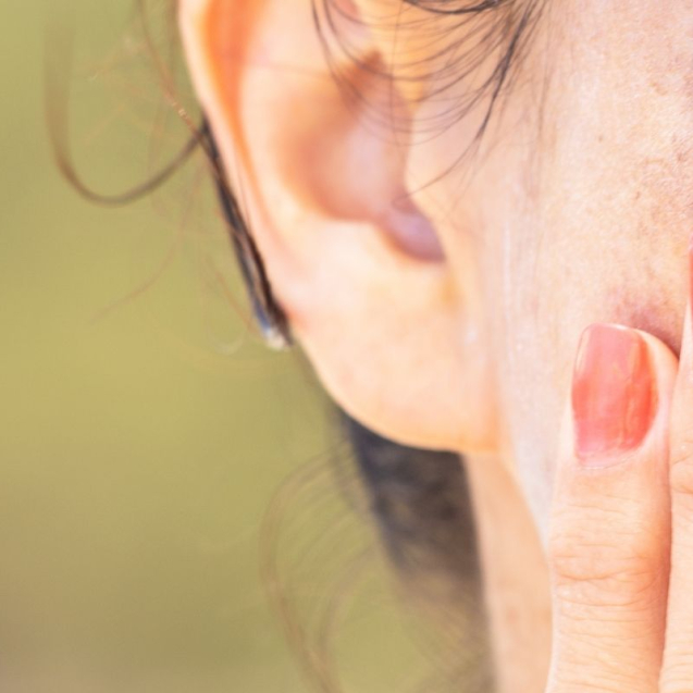 age spots vs freckles