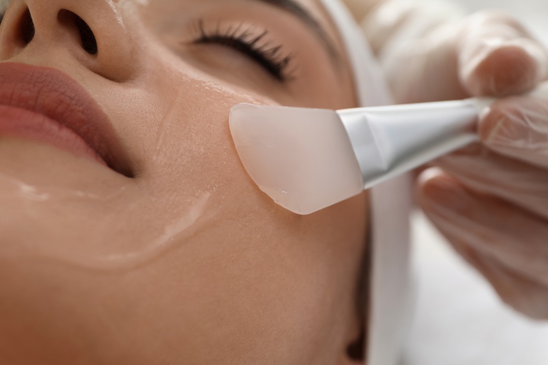 chemical peels